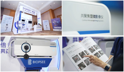 共聚焦可视化活检术 中国内镜技术突破'高精尖缺'的创新实践